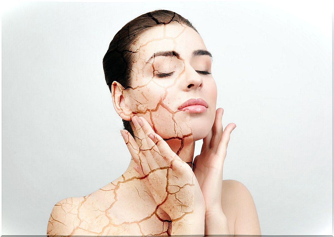 Woman with dry skin on her face.