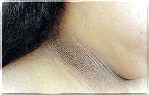 4 ways to remove dark neck