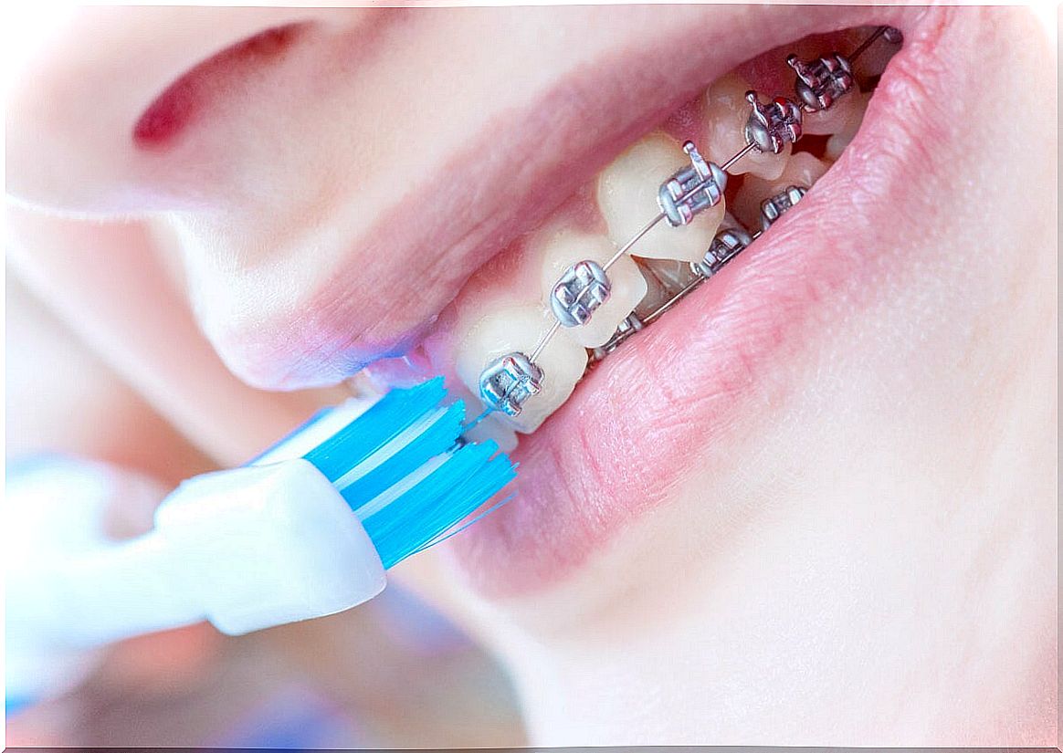 Tooth brushing for braces care.