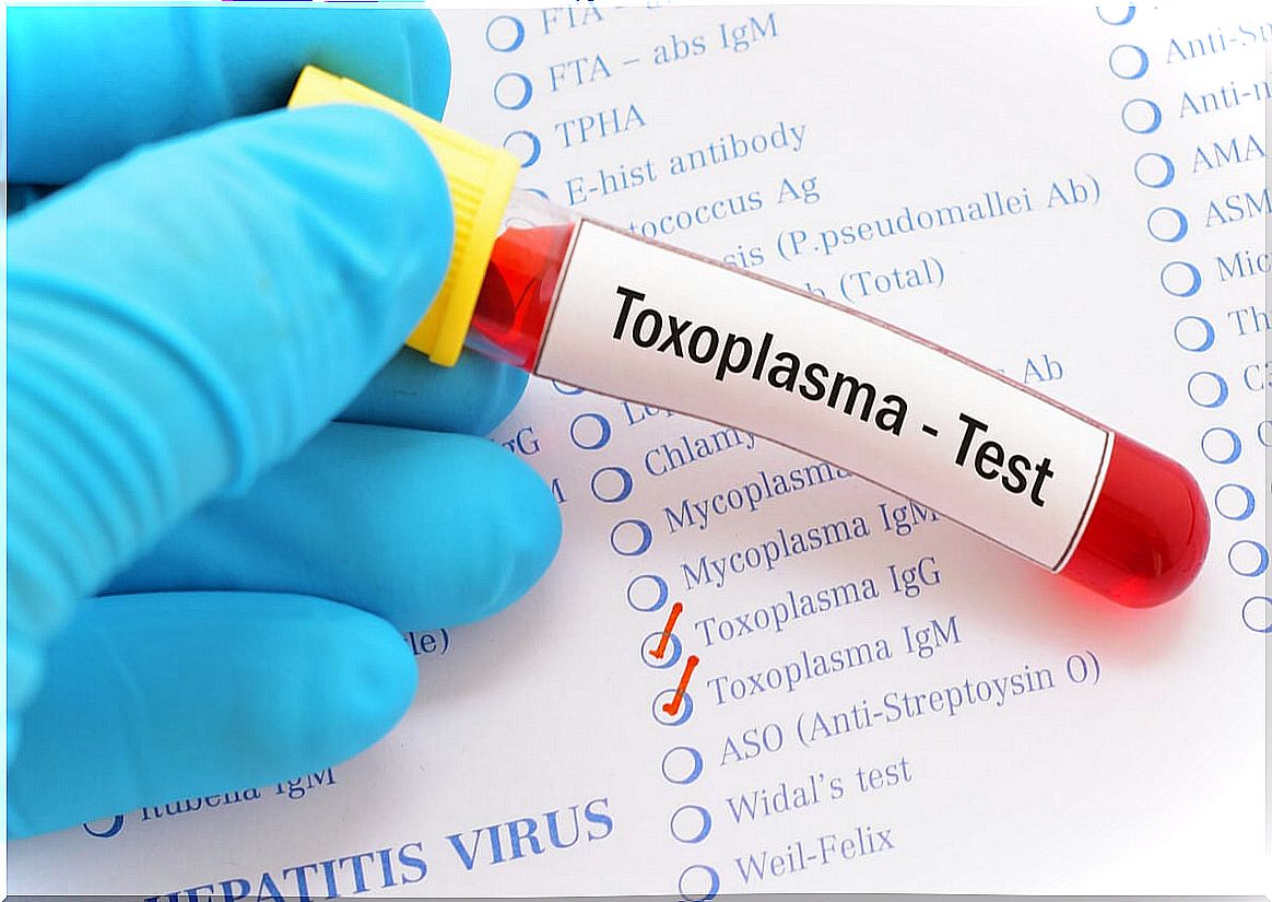 Toxoplasmosis test