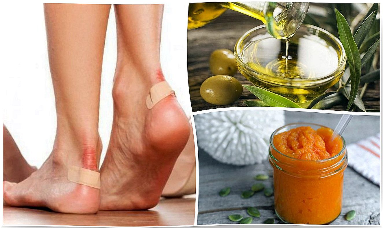 Relieve foot blisters with these 7 natural remedies